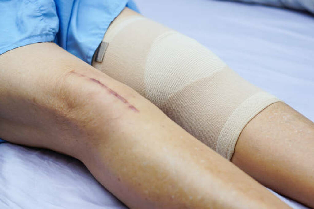 Best Minimally Invasive Knee Replacement In Panvel